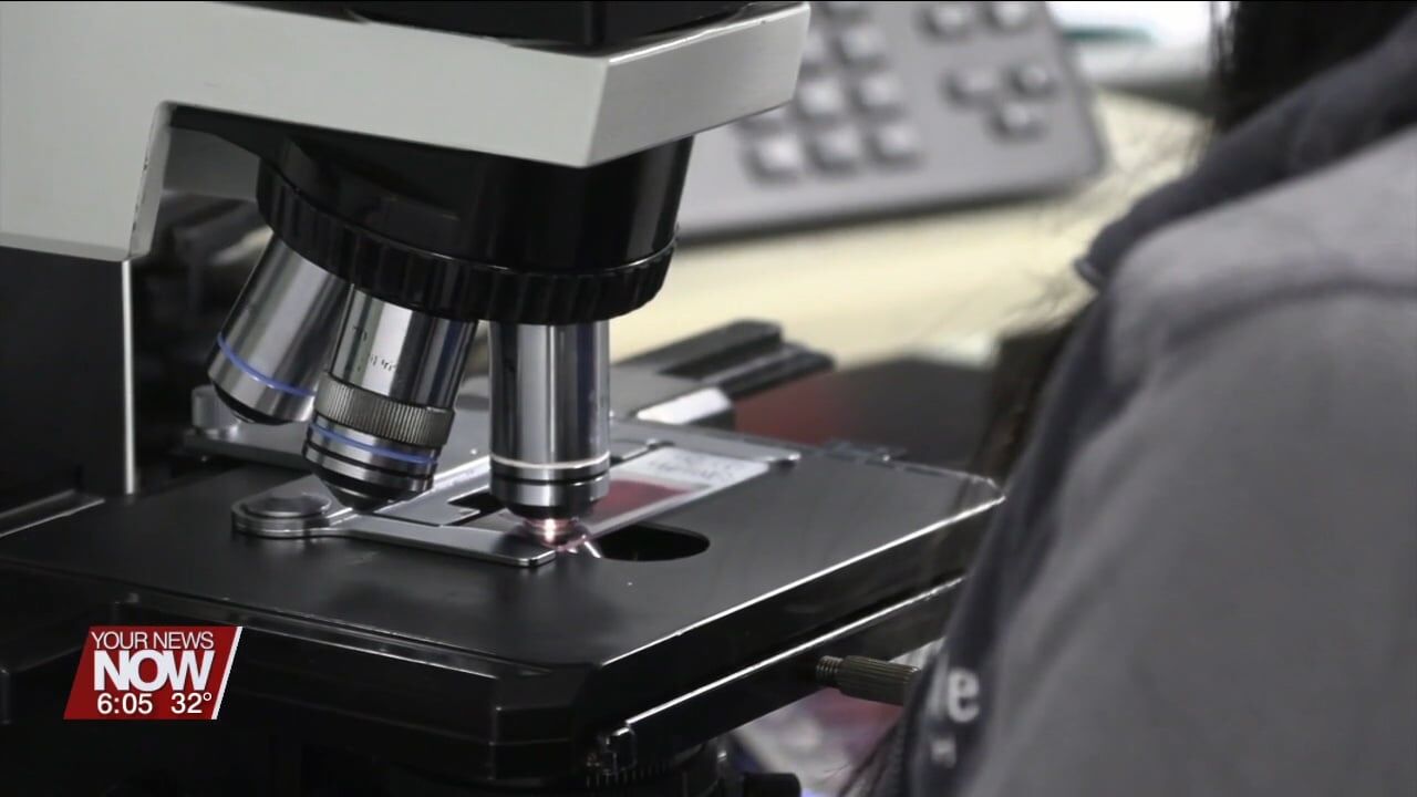 Lima Memorial Health System is now offering Direct Access Testing for patients